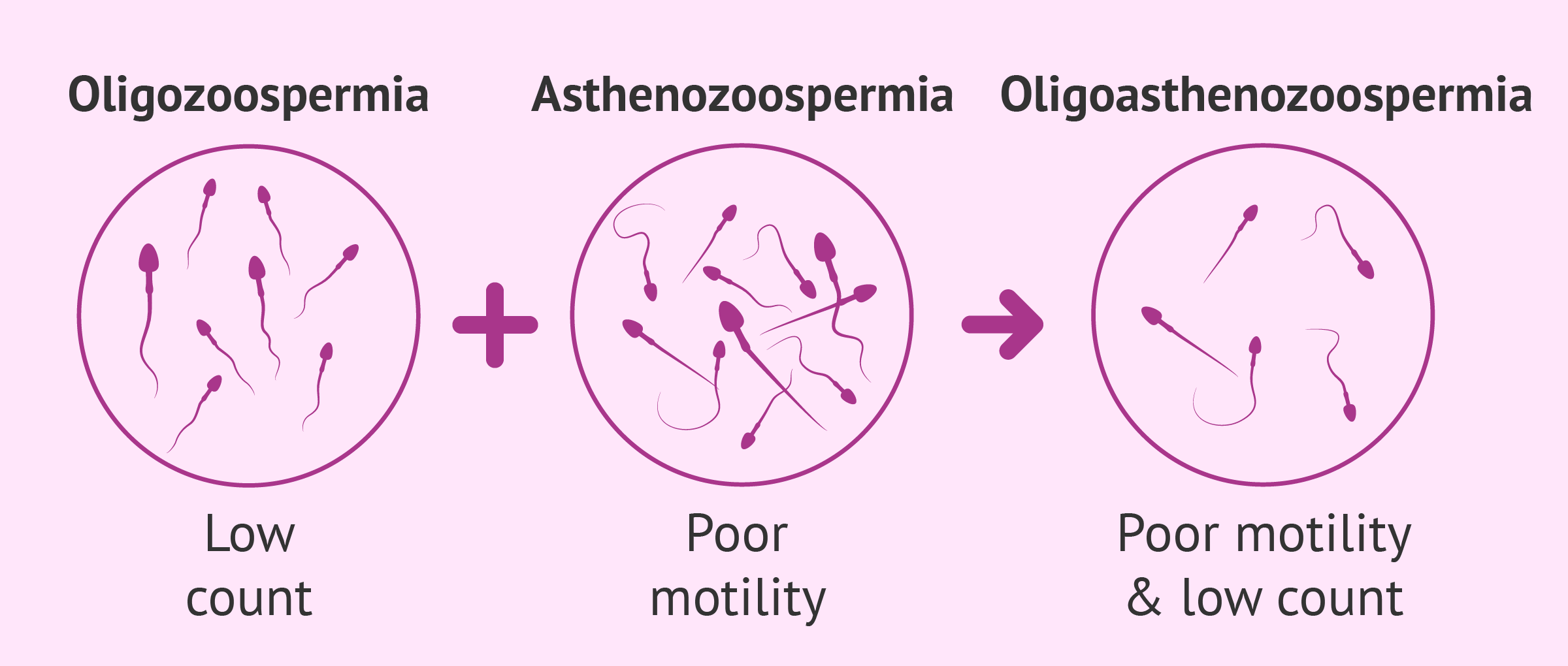 oligoasthenozoospermia