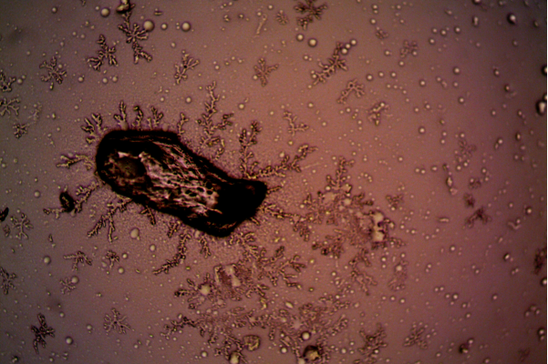 How Semen Microbiome Could Affect Male Fertility